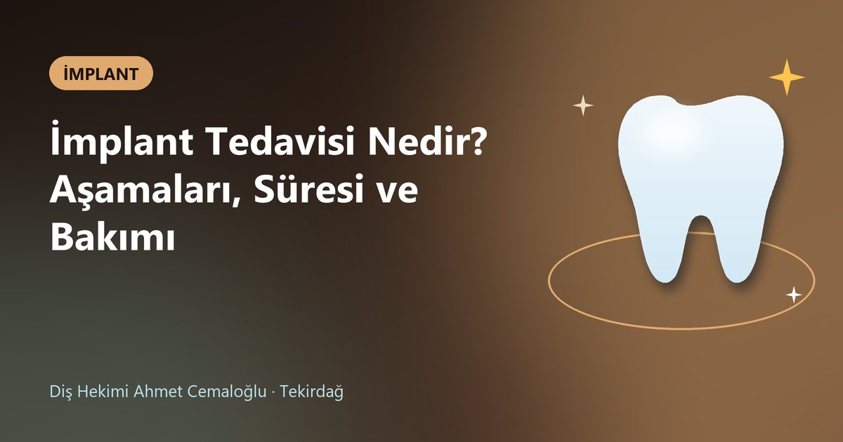 İmplant Tedavisi Nedir? Aşamaları, Süresi ve Bakımı – Dt. Ahmet Cemaloğlu blog kapak görseli